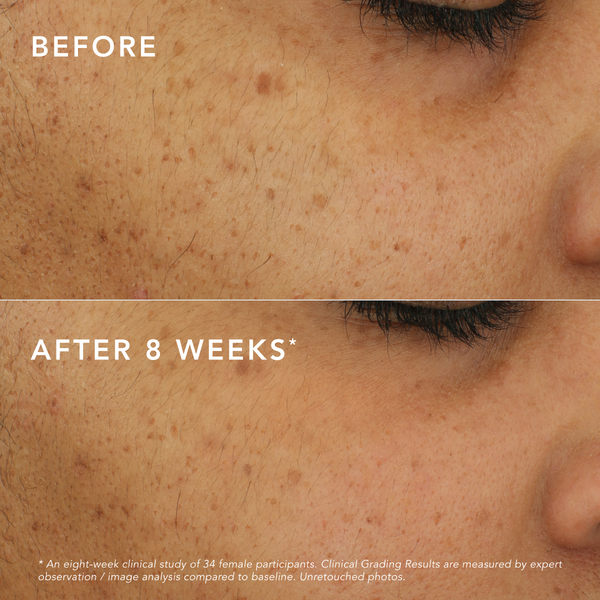 C-Bright Dark Spot Corrector Treatments
