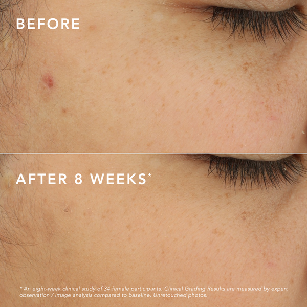 C-Bright Dark Spot Corrector Treatments